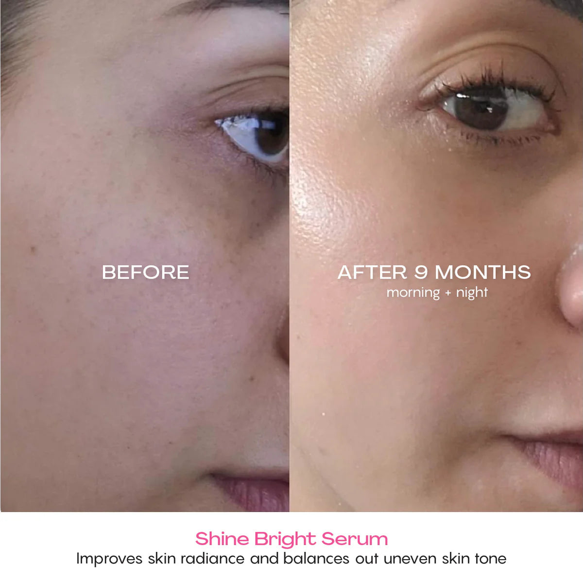 Shine Bright Serum