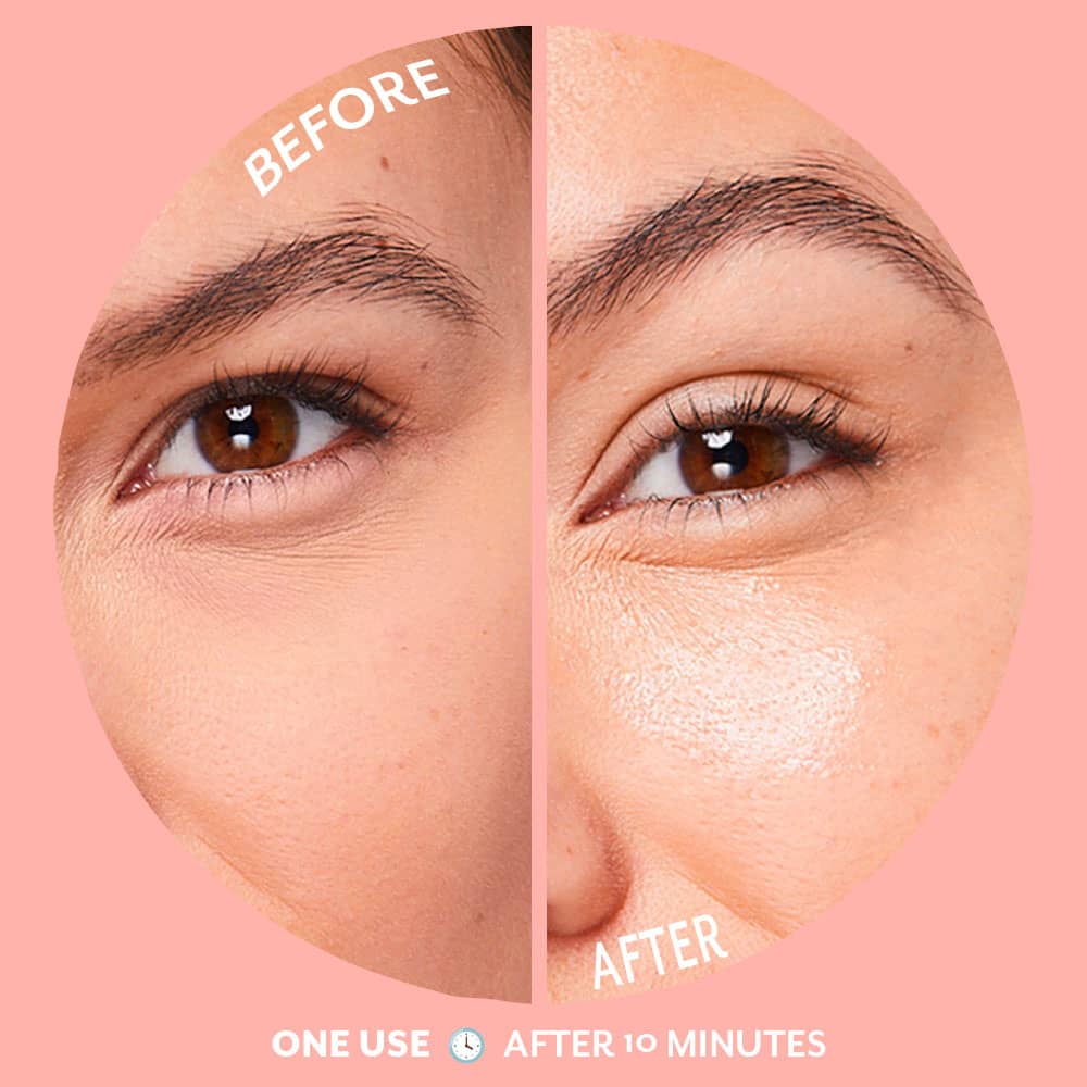Bubbly Under Eye Patches